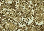 TAF7L Antibody - 1:100 staining mouse testis tissue by IHC-P. The sample was formaldehyde fixed and a heat mediated antigen retrieval step in citrate buffer was performed. The sample was then blocked and incubated with the antibody for 1.5 hours at 22°C. An HRP conjugated goat anti-rabbit antibody was used as the secondary.