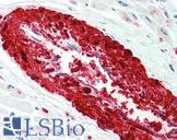 TAGLN / Transgelin / SM22 Antibody - Anti-TAGLN / Transgelin / SM22 antibody IHC staining of human heart. Immunohistochemistry of formalin-fixed, paraffin-embedded tissue after heat-induced antigen retrieval.