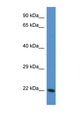 TAGLN3 / Neuronal Protein 22 Antibody - TAGLN3 antibody Western blot of Mouse Liver lysate. Antibody concentration 1 ug/ml. This image was taken for the unconjugated form of this product. Other forms have not been tested.