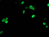 TAL1 Antibody - Anti-TAL1 mouse monoclonal antibody immunofluorescent staining of COS7 cells transiently transfected by pCMV6-ENTRY TAL1.