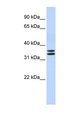 TAL1 Antibody - TAL1 antibody Western blot of Fetal Brain lysate. This image was taken for the unconjugated form of this product. Other forms have not been tested.