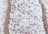 TAOK1 / TAO1 Antibody - 1:100 staining mouse brain tissue by IHC-P. The sample was formaldehyde fixed and a heat mediated antigen retrieval step in citrate buffer was performed. The sample was then blocked and incubated with the antibody for 1.5 hours at 22°C. An HRP conjugated goat anti-rabbit antibody was used as the secondary.