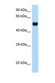 TAPBPL / TAPBPR Antibody - TAPBPL antibody Western blot of Mouse Brain lysate. Antibody concentration 1 ug/ml.  This image was taken for the unconjugated form of this product. Other forms have not been tested.