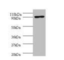 Taq DNA Polymerase Antibody - Western blot All lanes: Aquaticus DNA polymerase I, thermostable antibody at 2µg/ml + 293T whole cell lysate Secondary Goat polyclonal to rabbit IgG at 1/10000 dilution Predicted band size: 94 kDa Observed band size: 94 kDa