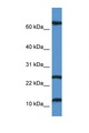 TARP / CD3G Antibody - TARP antibody Western blot of Jurkat Cell lysate. Antibody concentration 1 ug/ml.  This image was taken for the unconjugated form of this product. Other forms have not been tested.