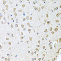 TARS Antibody - Immunohistochemistry of paraffin-embedded mouse brain tissue.