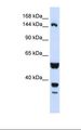 TARSH / ABI3BP Antibody - Hela cell lysate. Antibody concentration: 1.0 ug/ml. Gel concentration: 6-18%.  This image was taken for the unconjugated form of this product. Other forms have not been tested.