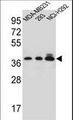 TAS2R1 Antibody - TAS2R1 Antibody western blot of MDA-MB231,293,NCI-H292 cell line lysates (35 ug/lane). The TAS2R1 antibody detected the TAS2R1 protein (arrow).