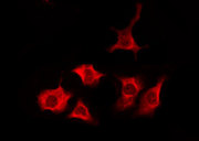TAS2R1 Antibody - Staining MCF-7 cells by IF/ICC. The samples were fixed with PFA and permeabilized in 0.1% Triton X-100, then blocked in 10% serum for 45 min at 25°C. The primary antibody was diluted at 1:200 and incubated with the sample for 1 hour at 37°C. An Alexa Fluor 594 conjugated goat anti-rabbit IgG (H+L) Ab, diluted at 1/600, was used as the secondary antibody.