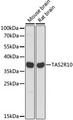 TAS2R10 / TRB2 Antibody - Western blot analysis of extracts of various cell lines, using TAS2R10 antibody at 1:1000 dilution. The secondary antibody used was an HRP Goat Anti-Rabbit IgG (H+L) at 1:10000 dilution. Lysates were loaded 25ug per lane and 3% nonfat dry milk in TBST was used for blocking. An ECL Kit was used for detection and the exposure time was 5s.