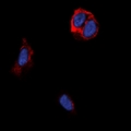 TAS2R14 / TRB1 Antibody - Immunofluorescent analysis of TRB1 staining in MCF7 cells. Formalin-fixed cells were permeabilized with 0.1% Triton X-100 in TBS for 5-10 minutes and blocked with 3% BSA-PBS for 30 minutes at room temperature. Cells were probed with the primary antibody in 3% BSA-PBS and incubated overnight at 4 deg C in a humidified chamber. Cells were washed with PBST and incubated with a DyLight 594-conjugated secondary antibody (red) in PBS at room temperature in the dark. DAPI was used to stain the cell nuclei (blue).