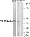 TAS2R20 / TAS2R49 Antibody - Western blot analysis of lysates from COLO and HepG2 cells, using TAS2R49 Antibody. The lane on the right is blocked with the synthesized peptide.