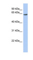 TBC1D10B Antibody - TBC1D10B antibody Western blot of Fetal stomach lysate. This image was taken for the unconjugated form of this product. Other forms have not been tested.