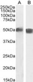 TBC1D10C / CARABIN Antibody - TBC1D10C / CARABIN antibody (2µg/ml) staining of Human Spleen (A) and Mouse Thymus (B) lysate (35µg protein in RIPA buffer). Detected by chemiluminescence.