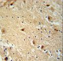 TBC1D14 Antibody - TBC14 antibody immunohistochemistry of formalin-fixed and paraffin-embedded human brain tissue followed by peroxidase-conjugated secondary antibody and DAB staining.
