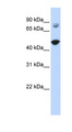 TBC1D16 Antibody - TBC1D16 antibody Western blot of Transfected 293T cell lysate. This image was taken for the unconjugated form of this product. Other forms have not been tested.
