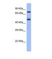 TBC1D25 Antibody - Western blot of Human Fetal Small Intestine. TBC1D25 antibody dilution 1.0 ug/ml.  This image was taken for the unconjugated form of this product. Other forms have not been tested.