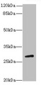 TBC1D26 Antibody - Western blot All lanes: TBC1D26 antibody at 3µg/ml + Mouse liver tissue Secondary Goat polyclonal to rabbit IgG at 1/10000 dilution Predicted band size: 29, 25, 10 kDa Observed band size: 29 kDa