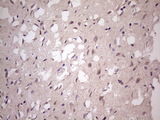 TBC1D28 Antibody - IHC of paraffin-embedded Human adult brain tissue using anti-TBC1D28 mouse monoclonal antibody. (Heat-induced epitope retrieval by 1 mM EDTA in 10mM Tris, pH8.5, 120°C for 3min)(1:150).