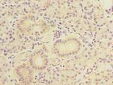TBC1D9B Antibody - Immunohistochemistry of paraffin-embedded human pancreatic tissue using antibody at dilution of 1:100.