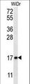 TBCA Antibody - TBCA Antibody western blot of WiDr cell line lysates (35 ug/lane). The TBCA antibody detected the TBCA protein (arrow).