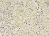 TBCA Antibody - Immunohistochemistry of paraffin-embedded human pancreatic tissue using antibody at dilution of 1:100.