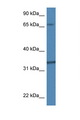 TBCB / CKAP1 Antibody - TBCB / CKAP1 antibody Western blot of Mouse Thymus lysate. Antibody concentration 1 ug/ml. This image was taken for the unconjugated form of this product. Other forms have not been tested.