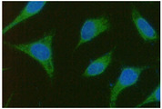 TBCEL / E-Like Antibody - ICC/IF analysis of TBCEL in PC3 cells line, stained with DAPI (Blue) for nucleus staining and monoclonal anti-human TBCEL antibody (1:100) with goat anti-mouse IgG-Alexa fluor 488 conjugate (Green).