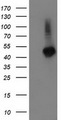 TBCEL / E-Like Antibody - HEK293T cells were transfected with the pCMV6-ENTRY control (Left lane) or pCMV6-ENTRY TBCEL (Right lane) cDNA for 48 hrs and lysed. Equivalent amounts of cell lysates (5 ug per lane) were separated by SDS-PAGE and immunoblotted with anti-TBCEL.