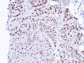 TBL1XR1 / TBLR1 Antibody - IHC of paraffin-embedded Cal27 Xenograft using TBLR1 antibody at 1:100 dilution.