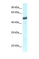 TBL1XR1 / TBLR1 Antibody - TBL1XR1 antibody Western blot of Jurkat Cell lysate. Antibody concentration 1 ug/ml.  This image was taken for the unconjugated form of this product. Other forms have not been tested.