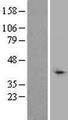TBL1XR1 / TBLR1 Protein - Western validation with an anti-DDK antibody * L: Control HEK293 lysate R: Over-expression lysate