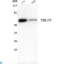 TBL1Y / TBL1 Antibody - Western Blot (WB) analysis using TBL1Y Monoclonal Antibody against Y79, HeLa cell lysate.