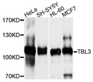 TBL3 Antibody - Western blot analysis of extracts of various cell lines, using TBL3 antibody at 1:1000 dilution. The secondary antibody used was an HRP Goat Anti-Rabbit IgG (H+L) at 1:10000 dilution. Lysates were loaded 25ug per lane and 3% nonfat dry milk in TBST was used for blocking. An ECL Kit was used for detection and the exposure time was 10s.
