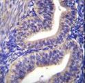 TBPL2 / TRF3 Antibody - TBPL2 Antibody immunohistochemistry of formalin-fixed and paraffin-embedded human uterus tissue followed by peroxidase-conjugated secondary antibody and DAB staining.