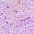 Antibody - Immunohistochemical analysis of TBX15/18 staining in human brain formalin fixed paraffin embedded tissue section. The section was pre-treated using heat mediated antigen retrieval with sodium citrate buffer (pH 6.0). The section was then incubated with the antibody at room temperature and detected using an HRP conjugated compact polymer system. DAB was used as the chromogen. The section was then counterstained with hematoxylin and mounted with DPX.