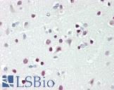 TBX15 Antibody - Human Brain, Cortex: Formalin-Fixed, Paraffin-Embedded (FFPE).  This image was taken for the unconjugated form of this product. Other forms have not been tested.