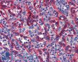 TBX18 Antibody - Anti-TBX18 antibody IHC of human spleen. Immunohistochemistry of formalin-fixed, paraffin-embedded tissue after heat-induced antigen retrieval. Antibody concentration 5 ug/ml.  This image was taken for the unconjugated form of this product. Other forms have not been tested.