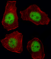 TBX21 / T-bet Antibody - Fluorescent image of A549 cell stained with TBX21 Antibody. A549 cells were fixed with 4% PFA (20 min), permeabilized with Triton X-100 (0.1%, 10 min), then incubated with TBX21 primary antibody (1:25, 1 h at 37°C). For secondary antibody, Alexa Fluor 488 conjugated donkey anti-rabbit antibody (green) was used (1:400, 50 min at 37°C). Cytoplasmic actin was counterstained with Alexa Fluor 555 (red) conjugated Phalloidin (7units/ml, 1 h at 37°C). TBX21 immunoreactivity is localized to Nucleus significantly.