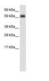 TBX21 / T-bet Antibody - Fetal Thymus Lysate.  This image was taken for the unconjugated form of this product. Other forms have not been tested.