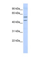 TBX22 Antibody - TBX22 antibody Western blot of 293T cell lysate. This image was taken for the unconjugated form of this product. Other forms have not been tested.
