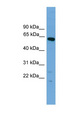 TBX22 Antibody - TBX22 antibody Western blot of Mouse Brain lysate. This image was taken for the unconjugated form of this product. Other forms have not been tested.