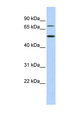 TBX3 Antibody - TBX3 antibody Western blot of 721_B cell lysate. This image was taken for the unconjugated form of this product. Other forms have not been tested.