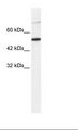 TBX3 Antibody - HepG2 Cell Lysate.  This image was taken for the unconjugated form of this product. Other forms have not been tested.