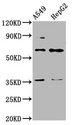 TBX4 Antibody - Western Blot Positive WB detected in: A549 whole cell lysate, HepG2 whole cell lysate All Lanes: TBX4 antibody at 4.3µg/ml Secondary Goat polyclonal to rabbit IgG at 1/50000 dilution Predicted band size: 61 KDa Observed band size: 61 KDa