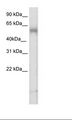 TBX6 Antibody - Placenta Lysate.  This image was taken for the unconjugated form of this product. Other forms have not been tested.
