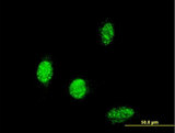 TBX6 Antibody - Immunofluorescence of monoclonal antibody to TBX6 on HeLa cell . [antibody concentration 10 ug/ml]