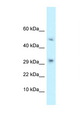 TCAIM Antibody - D9Ertd402e antibody Western blot of Mouse Pancreas lysate. Antibody concentration 1 ug/ml.  This image was taken for the unconjugated form of this product. Other forms have not been tested.
