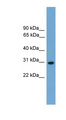 TCEA1 / TFIIS Antibody - TCEA1 antibody Western blot of Mouse Spleen lysate. This image was taken for the unconjugated form of this product. Other forms have not been tested.