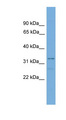 TCEA2 / TFIIS Antibody - TCEA2 antibody Western blot of Mouse Uterus lysate. This image was taken for the unconjugated form of this product. Other forms have not been tested.